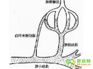 混合型慢性高原病